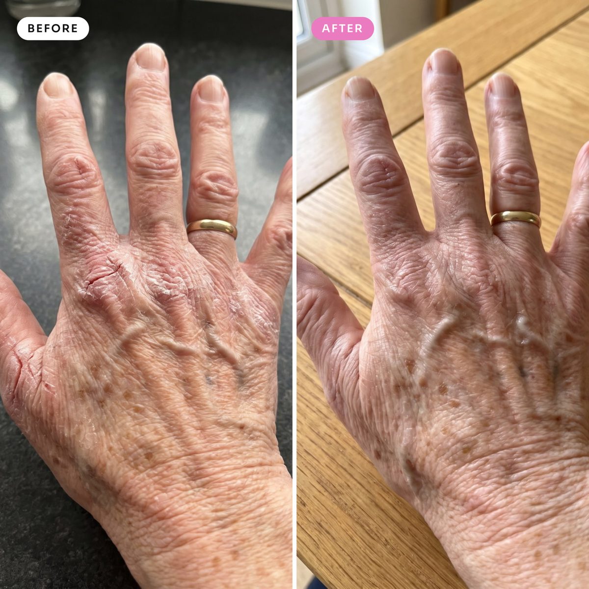 Before and after